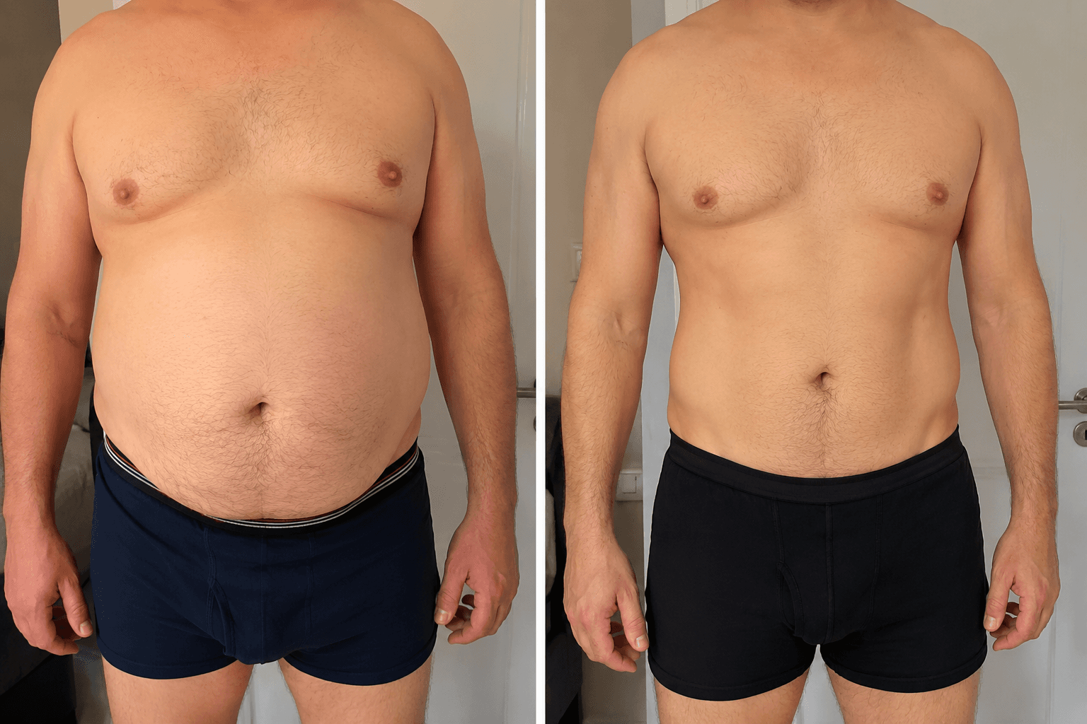 Before and after of a weight management case with GLP-1 treatment
